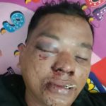 Gegara 4 Janjang Sawit Di Lahan BWS, Diduga Kades Denai Kuala Sewa Preman Untuk Aniaya Pelaku