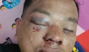 Gegara 4 Janjang Sawit Di Lahan BWS,  Diduga Kades Denai Kuala Sewa Preman Untuk Aniaya Pelaku
