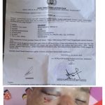 Pelaku Penganiayaan Bebas Berkeliaran Walau Sudah Dilapor Ke Polres